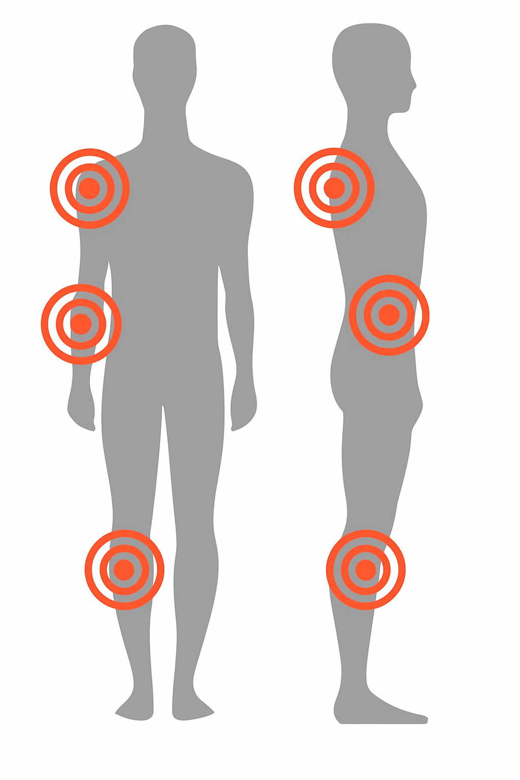 tendinopathy